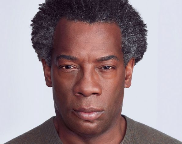 After Aesthetic Botox Treatments for frown eyebrows in Montreal