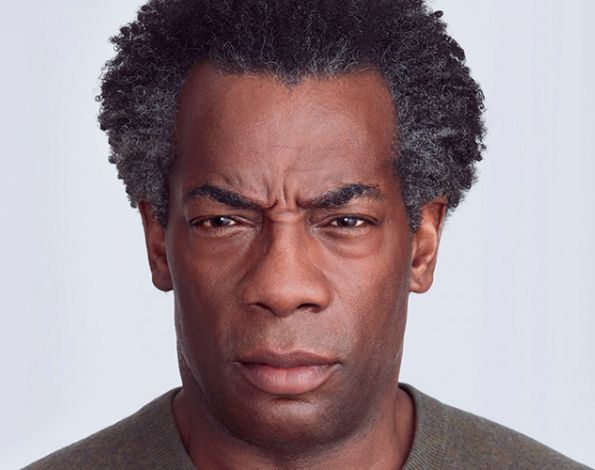 Before Aesthetic Botox Treatments for frown eyebrows in Montreal