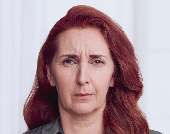 Before Aesthetic Botox Treatments for frown eyebrows in Montreal