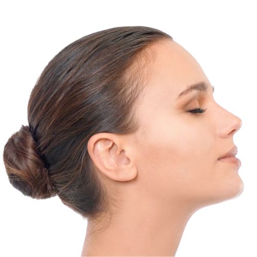 Belkyra Injection treatment for double chin in Montreal